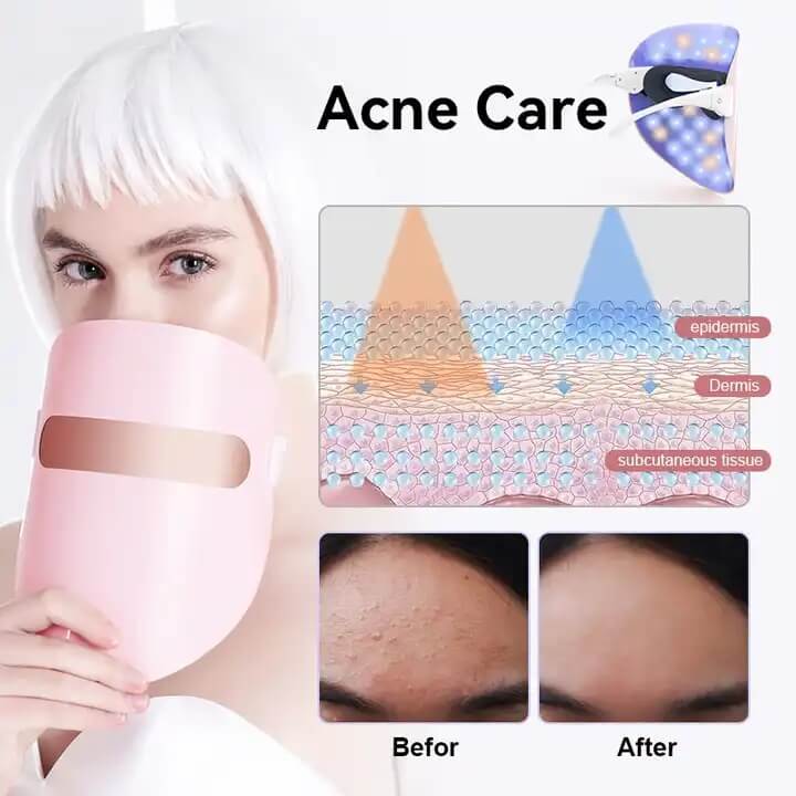 SKB-1818P الجمال الرعاية اللاسلكية لون ضوء العلاج أدى قناع الوجه 