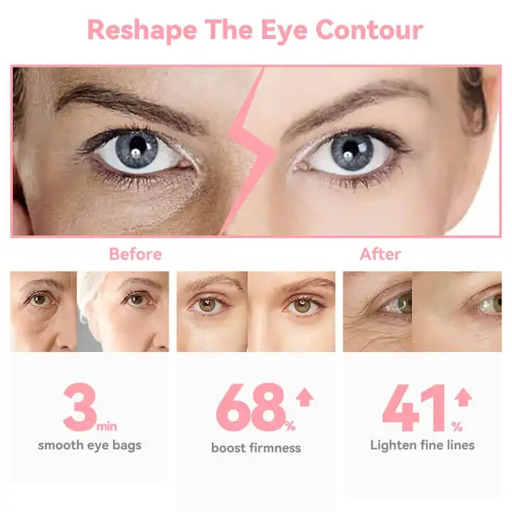 skb-1807 الاهتزاز الكهروحرارية تجعد مقاومة قلم رصاص العين الجمال القلم ضغط الساخنة مدلك العين 